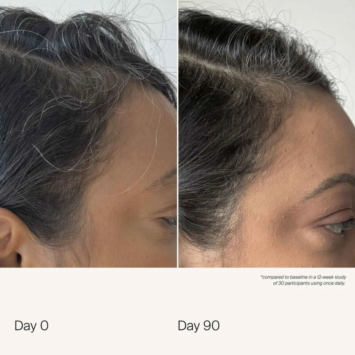 Scalp Care Density Serum